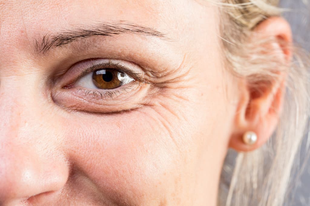 How do I get rid of puffiness under my eyes? • Illuminate Skin Clinics