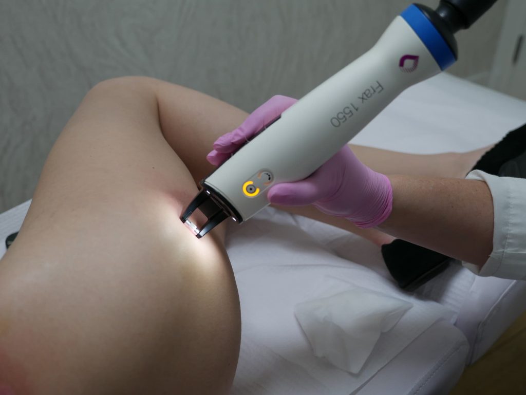 Frax Laser - body treatment